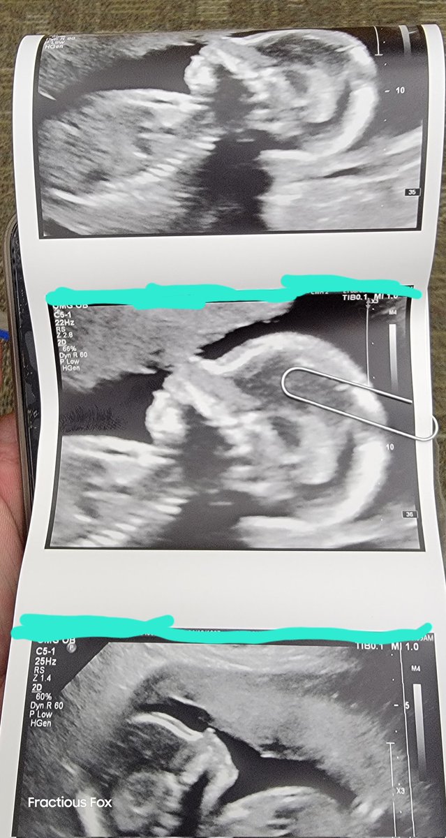 FractiousFox's tweet photo. @TaylorDRhodes2A Thanks! Congrats to you too! We are super excited! https://t.co/5dmSqPuGkG