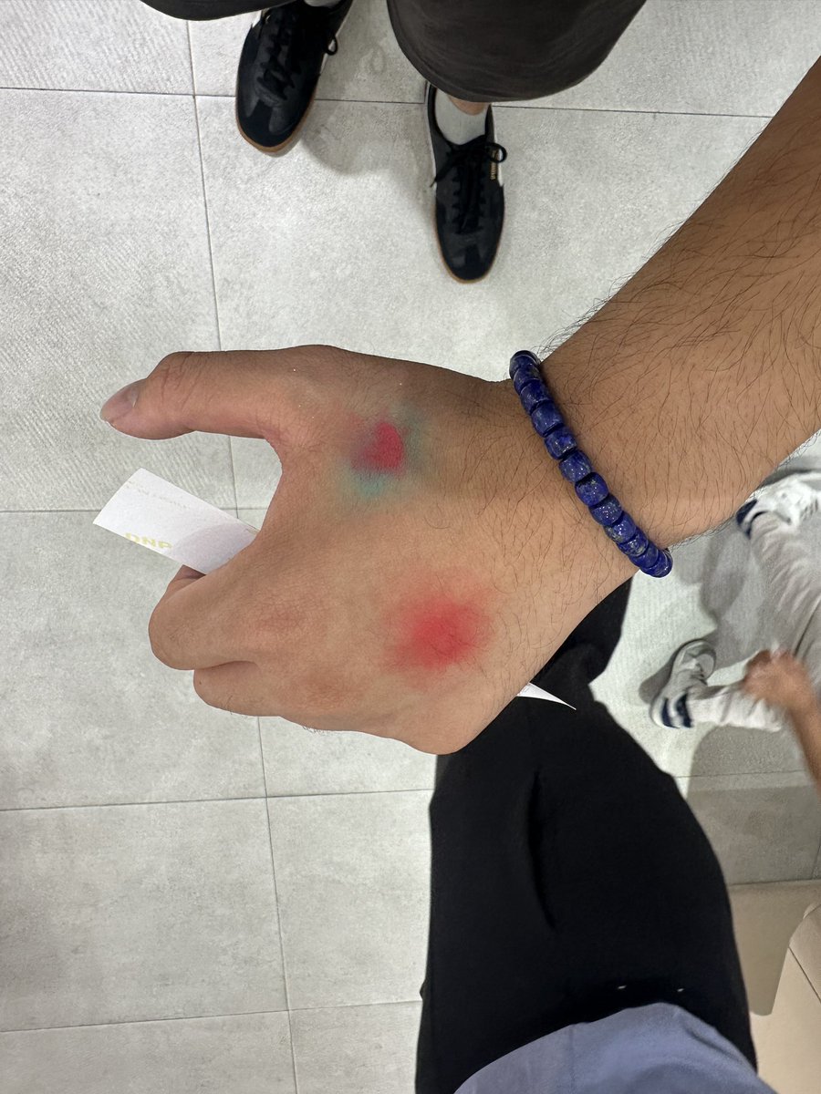 mikoolmikel's tweet photo. got a hickey๐๐๐๐๐๐๐ my blood is pink๐๐ #PinkFridayEra https://t.co/h0cbSAAtis