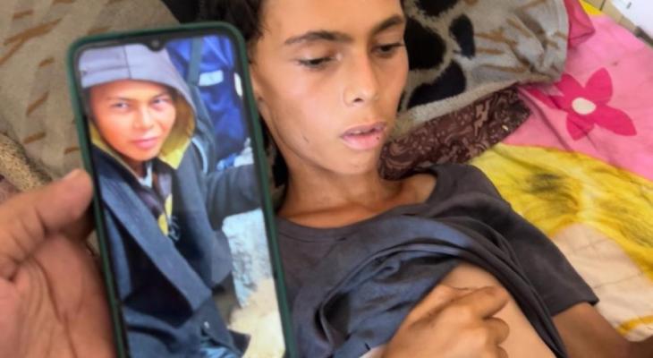 وفاة فتى في غزة نتيجة الجوع الشديد قبل قلبل
