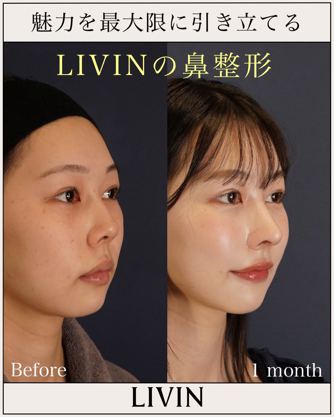 新行内芳明【顔全体を洗練させる美容外科医】 on X: 