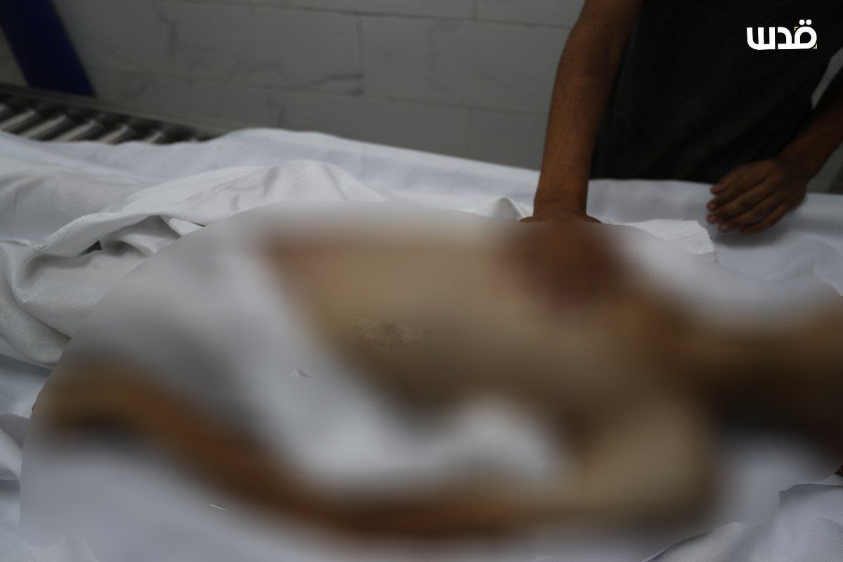 QudsNen's tweet photo. 17-year-old Atef Abu Khater died today of malnutrition due to the suffocating Israeli blockade on the Gaza Strip. His death raises the death toll of the victims of starvation and malnutrition to at least 149. https://t.co/TsEhPU7Ogm