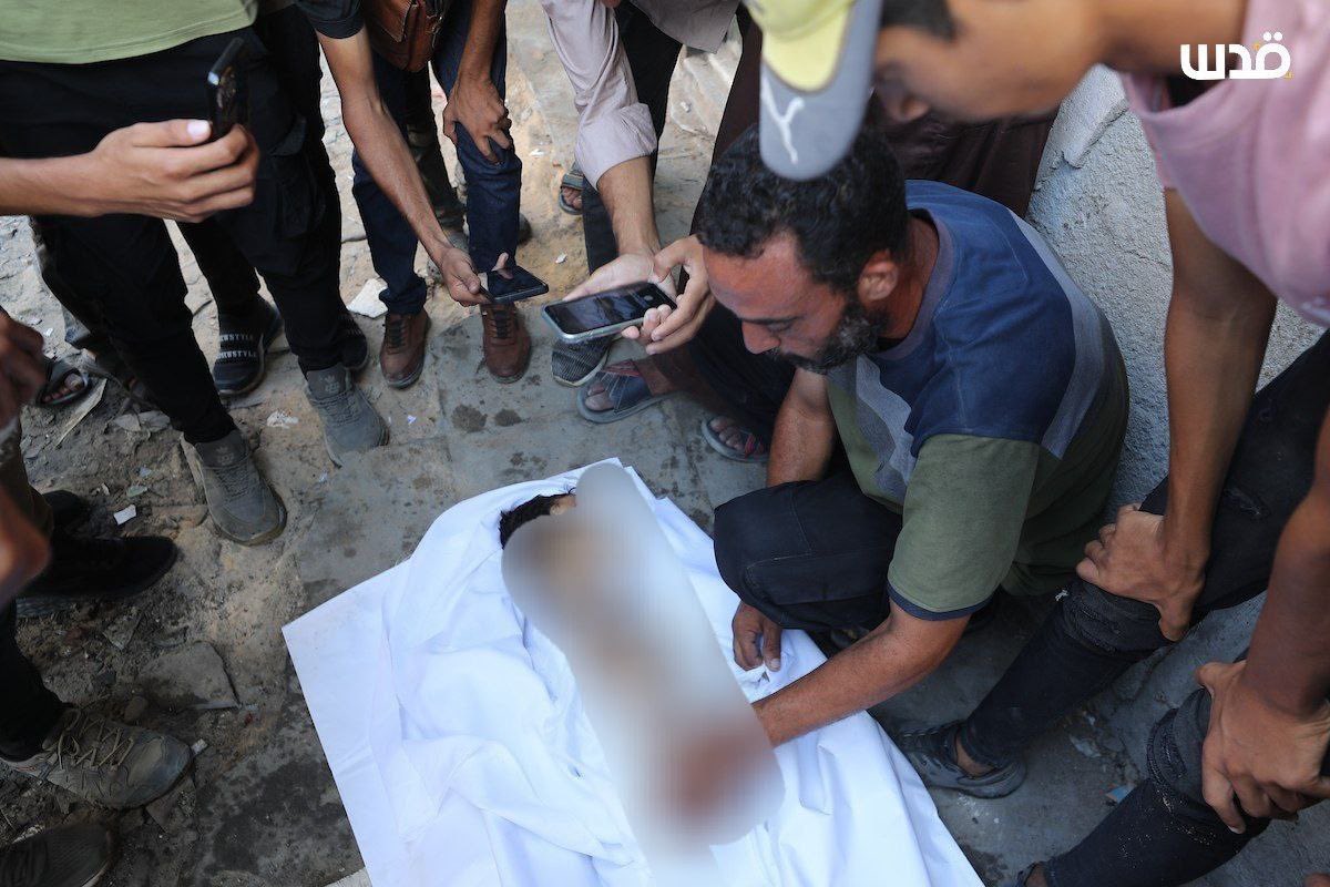 17 year-old Atef Abu Khater dies of the Israeli-enforced starvation of Gaza— his death raises the numbers of the killed-by-hunger to 149
