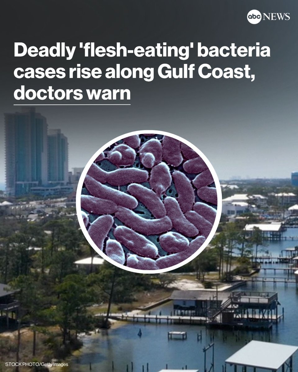 ABC's tweet photo. Health officials are warning of a rise in potentially deadly "flesh-eating" bacteria cases along the Gulf Coast, with Louisiana reporting higher numbers than usual this summer. https://t.co/T14rDPwgbe https://t.co/lbJOzjFs7T