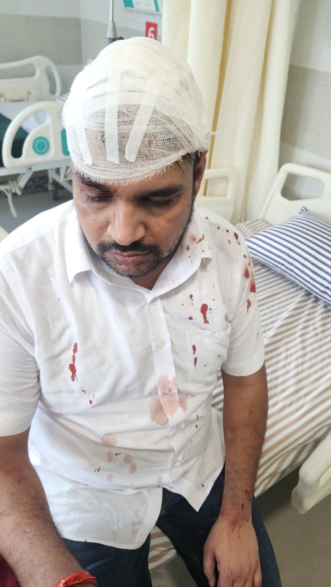 #लखनऊ-राष्ट्रीय हिंदी दैनिक कैनविज टाइम्स के स्टेट हेड पर जानलेवा हमला हुआ,सुशांत गोल्फ सिटी क्षेत्र में उनके घर के अंदर बदमाशों ने वारदात को दिया अंजाम,हमलावरों पर त्वरित कार्यवाही होनी चाहिए। <a href="/CMOfficeUP/">CM Office, GoUP</a> <a href="/yadavakhilesh/">Akhilesh Yadav</a> <a href="/dgpup/">DGP UP</a> <a href="/adgzonelucknow/">ADG Zone Lucknow</a> <a href="/Uppolice/">UP POLICE</a> <a href="/lkopolice/">LUCKNOW POLICE</a> <a href="/KanwhizTimes/">Kanwhizz Times</a>