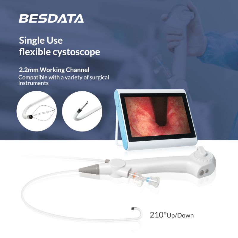 LeaBESDATA's tweet photo. Precise &amp; sterile single-use cystoscope! 🔍 120° FOV + 210° bend for clear bladder/urethra imaging. Zero cross-contamination risk.
#BESDATA #Cystoscope #Urology #HealthcareInnovation https://t.co/1H7ZpQTb8k