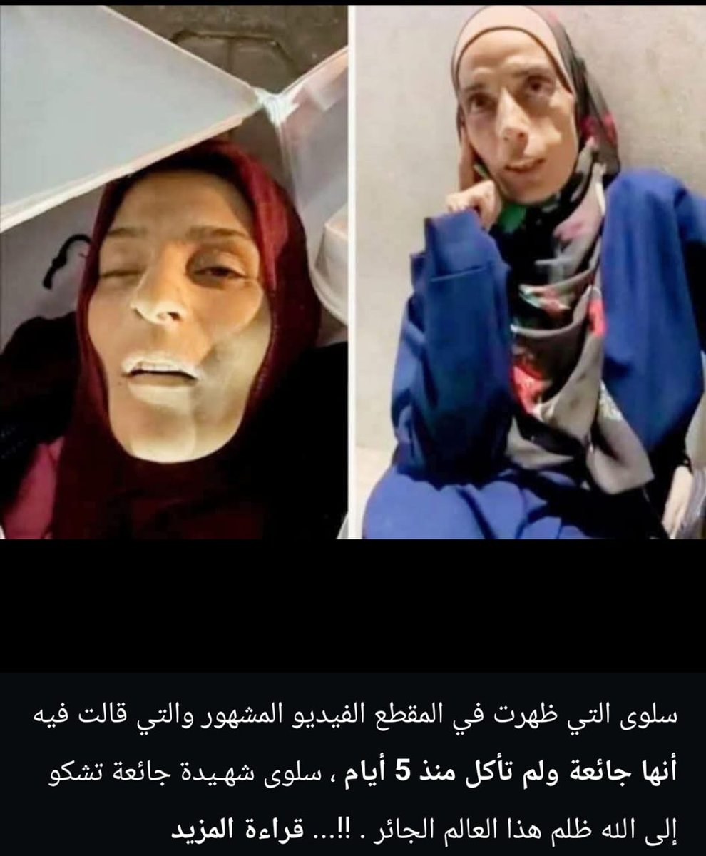 إلى أين العالم العربي والإسلامي ؟
صمٌ بكمٌ عمىٌ!
لاحول ولاقوة إلا بالله العلي العظيم