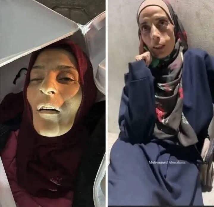 ماتت جوعاً يا مسلمين ، قبل بضعة أيام كانت في مقابلة وتقول أنه مضى عليها عشرة أيام بلا طعام حسبنا الله ونعم