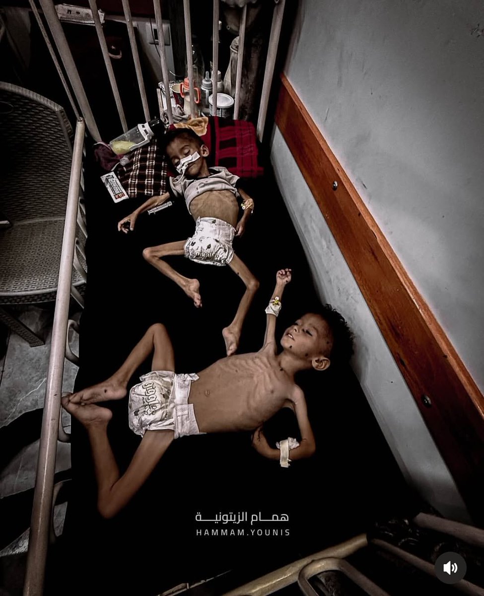 Gazze'de çocuklar açlıktan ölüyor