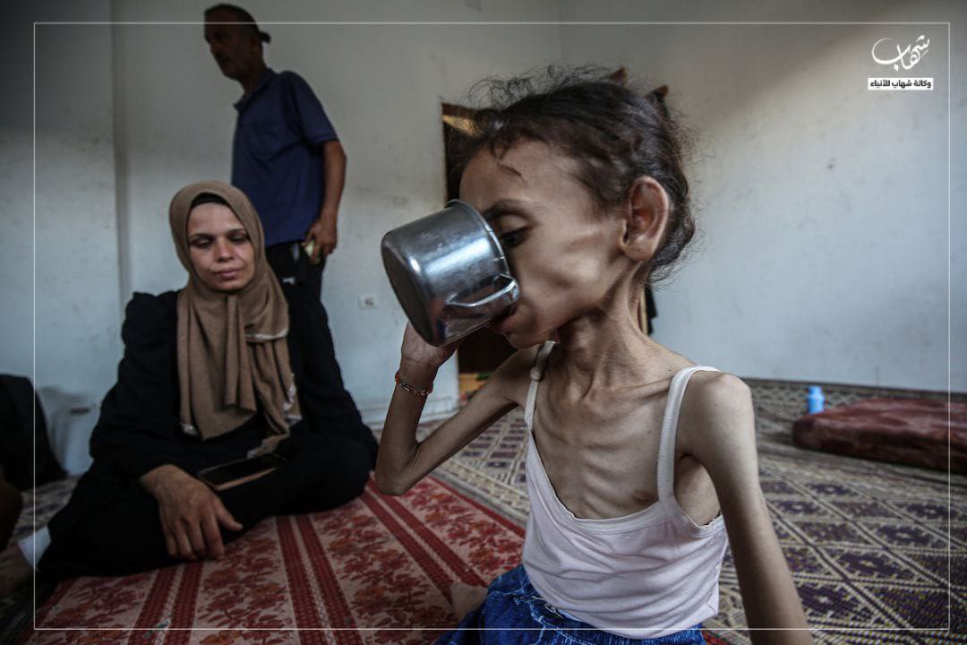 This is 9-year-old girl, Maryam Abdul Aziz Mahmoud Dawas who is suffering from severe malnutrition 

It had left her unable to walk, and her weight has dropped from 25 to 10 kilograms

This due to starvation war, the blockade and the Zionists closure of the crossings and
