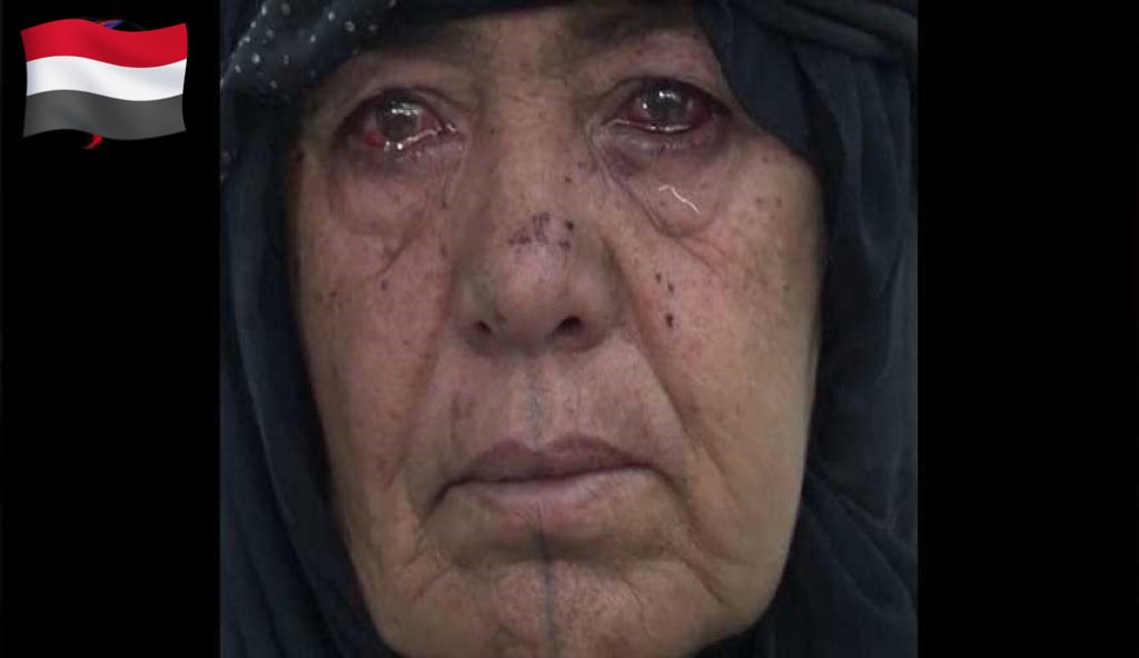 لدينا ملف إجرامي للسعودية سنجعلة يلف العالم كلة ان شاء الله بمساعدتكم ومشاركتكم للسلسلة الأجرامية السعودية ونشرها في كل صفحاتكم

#لن_ننسى  المنا وألم أمهاتنا وابائنا على الضحايا الأبرياء الذي استشهدوا بقصف وحشي وهمجي من قبل قوات التحالف السعودي 

فحجم الجرائم والمجازر السعودية