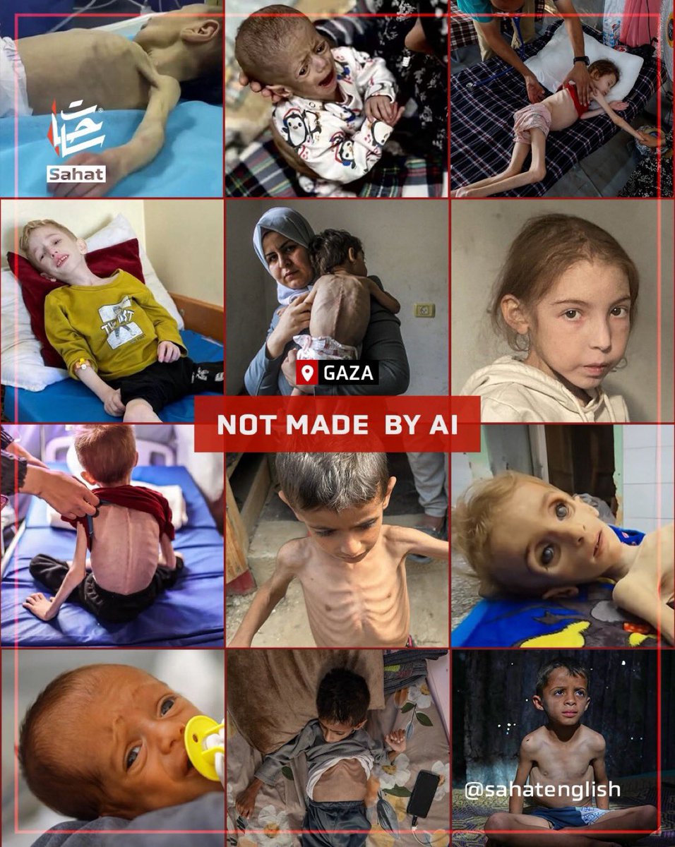 When a captured israeli in #Gaza shows signs of starvation, it’s the Palestinians, being starved, who’re accused of committing a holocaust