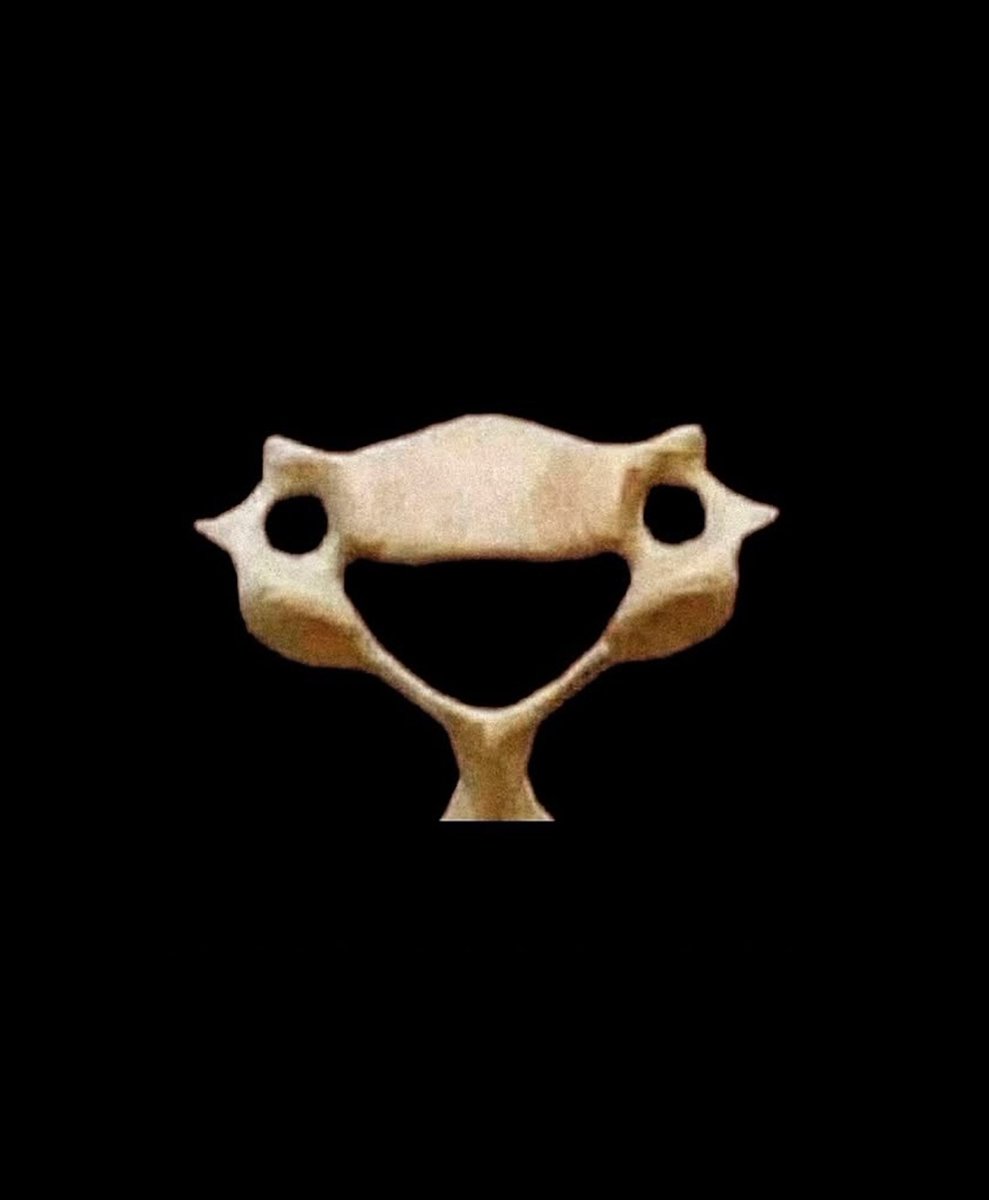 Если вы грустите, вспоминайте про этот веселый 6й шейный позвонок, который вас ежедневно поддерживает, и ничего, не грустит при этом 😊😉