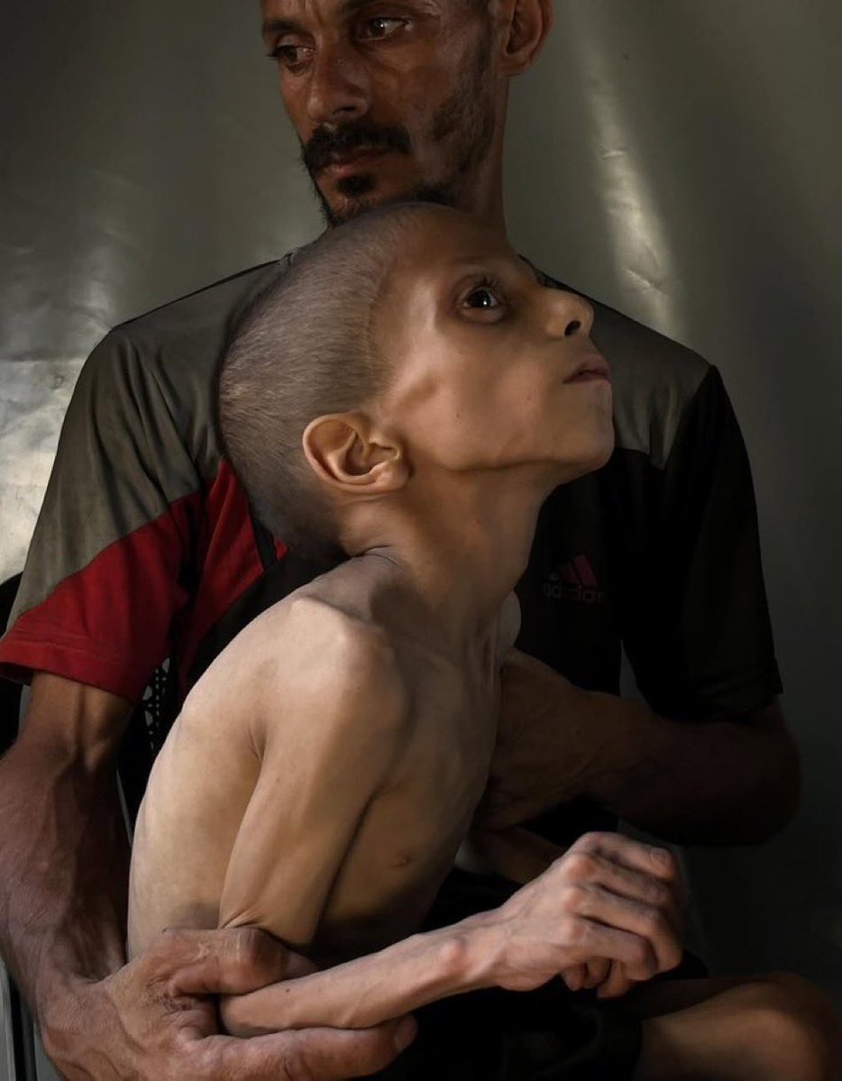 #GazaStarving 
02.08.2025