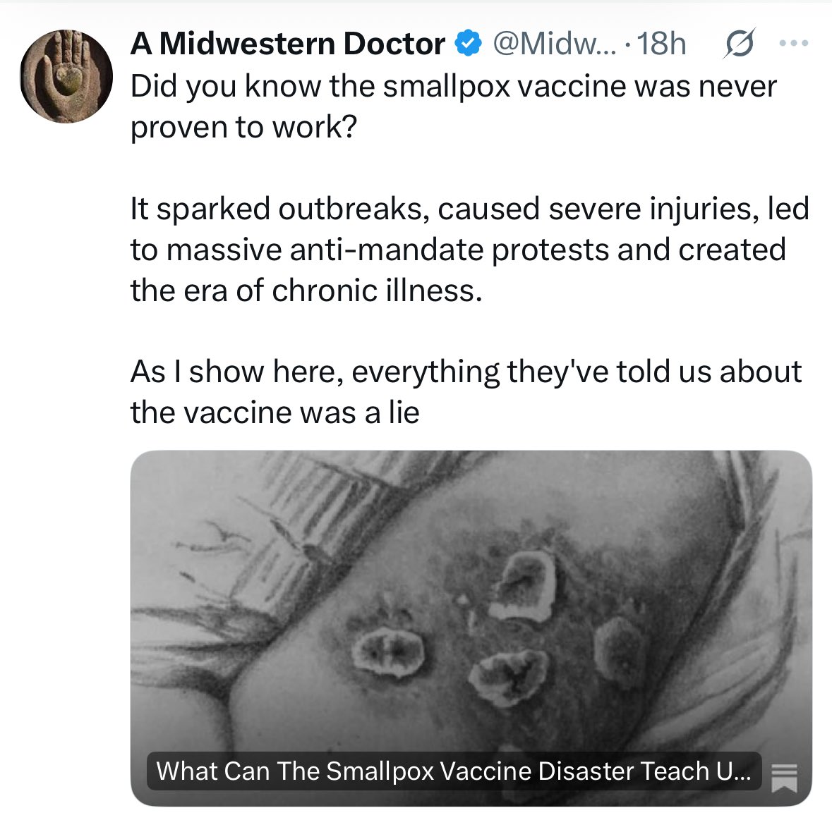 DrNeilStone's tweet image. Weapons grade bullshit 

Nonsense 

Garbage 

Crap 

That is all