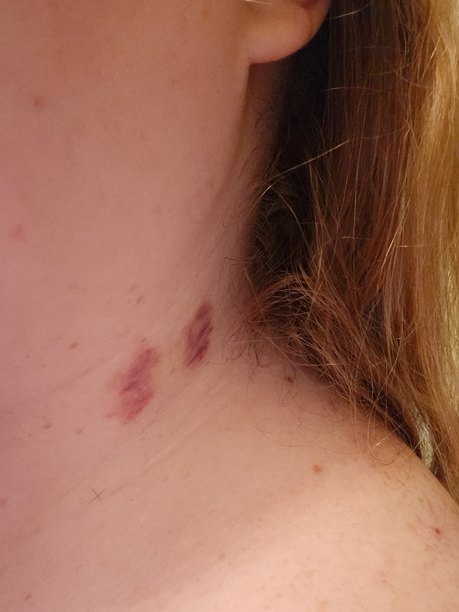 Puppies got some new bite marks 🥴💖