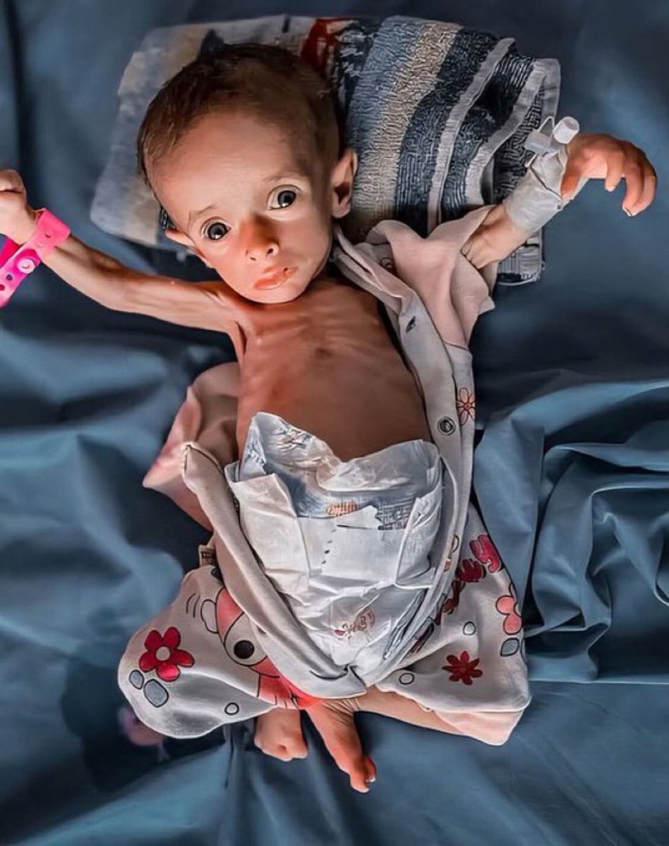 We are not beggars 💔 but forcibly starved

If you’re scrolling, PLEASE leave a dot . it's just a dot 😭🙏