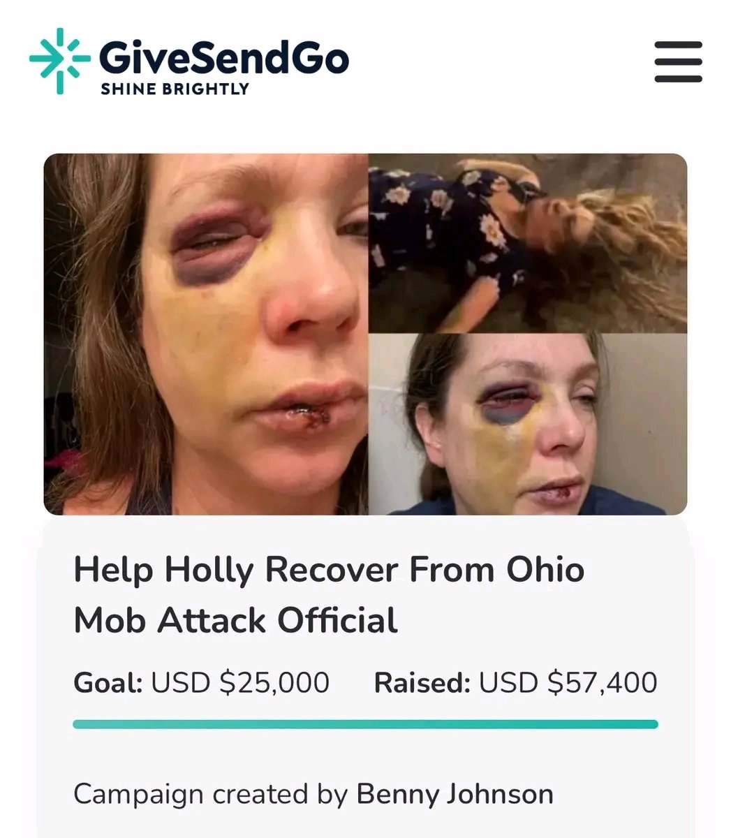 This is INSANE 🙏🏻🇺🇸

We have more than DOUBLED our Goal for Holly tonight.

She was beaten and left to dead and the American people are lifting her up. 

We are here for our fellow American.

God bless you. This is how we win. 

100% goes to Holly. Here: givesendgo.com/SupportHolly
