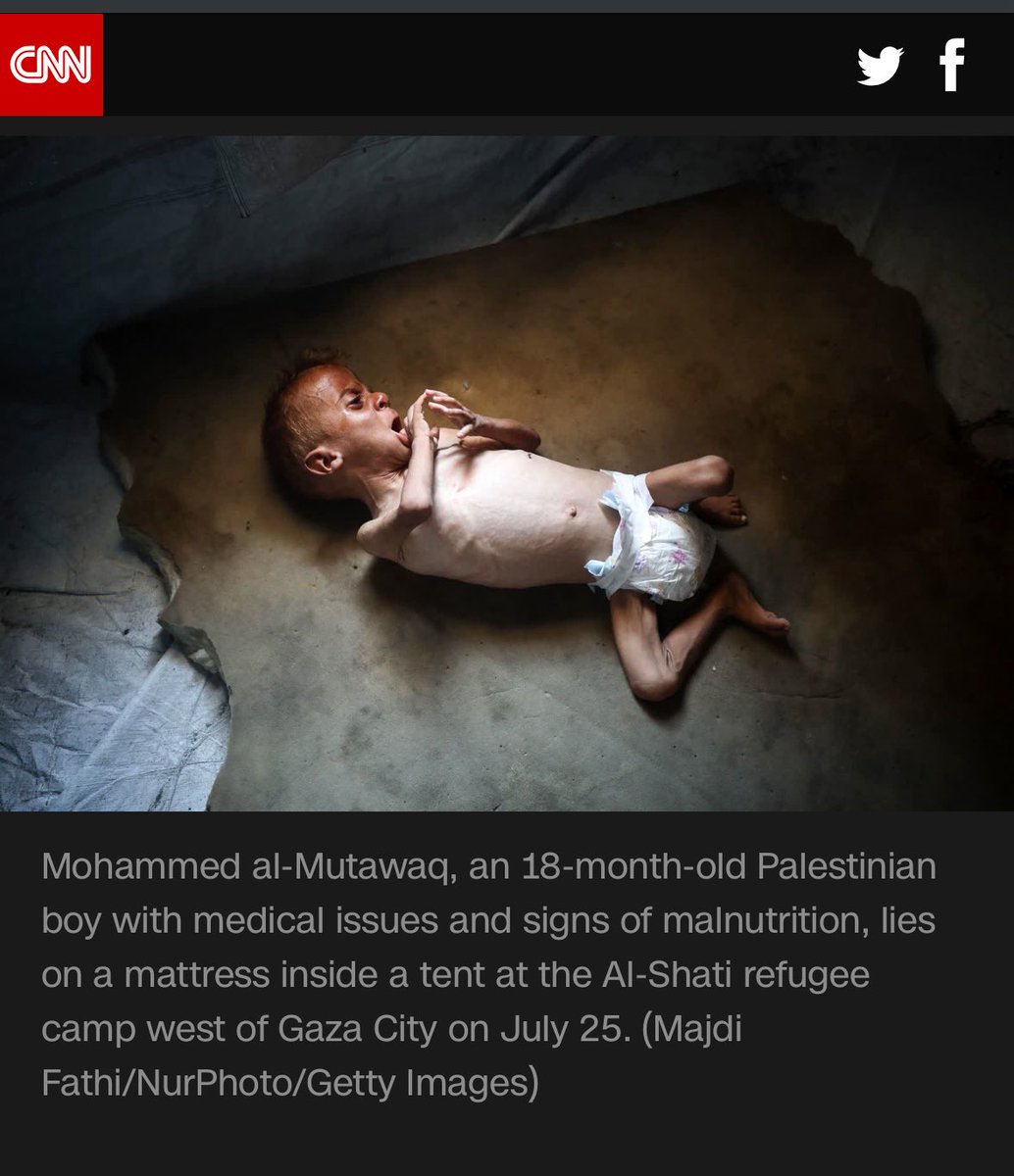 The media continues posting photos of deformed children suffering from pre-existing conditions and passing it off as starvation. This emotional manipulation is F’d up. And if there really is “famine” show me a group photo of emaciated Gazans. You can’t.