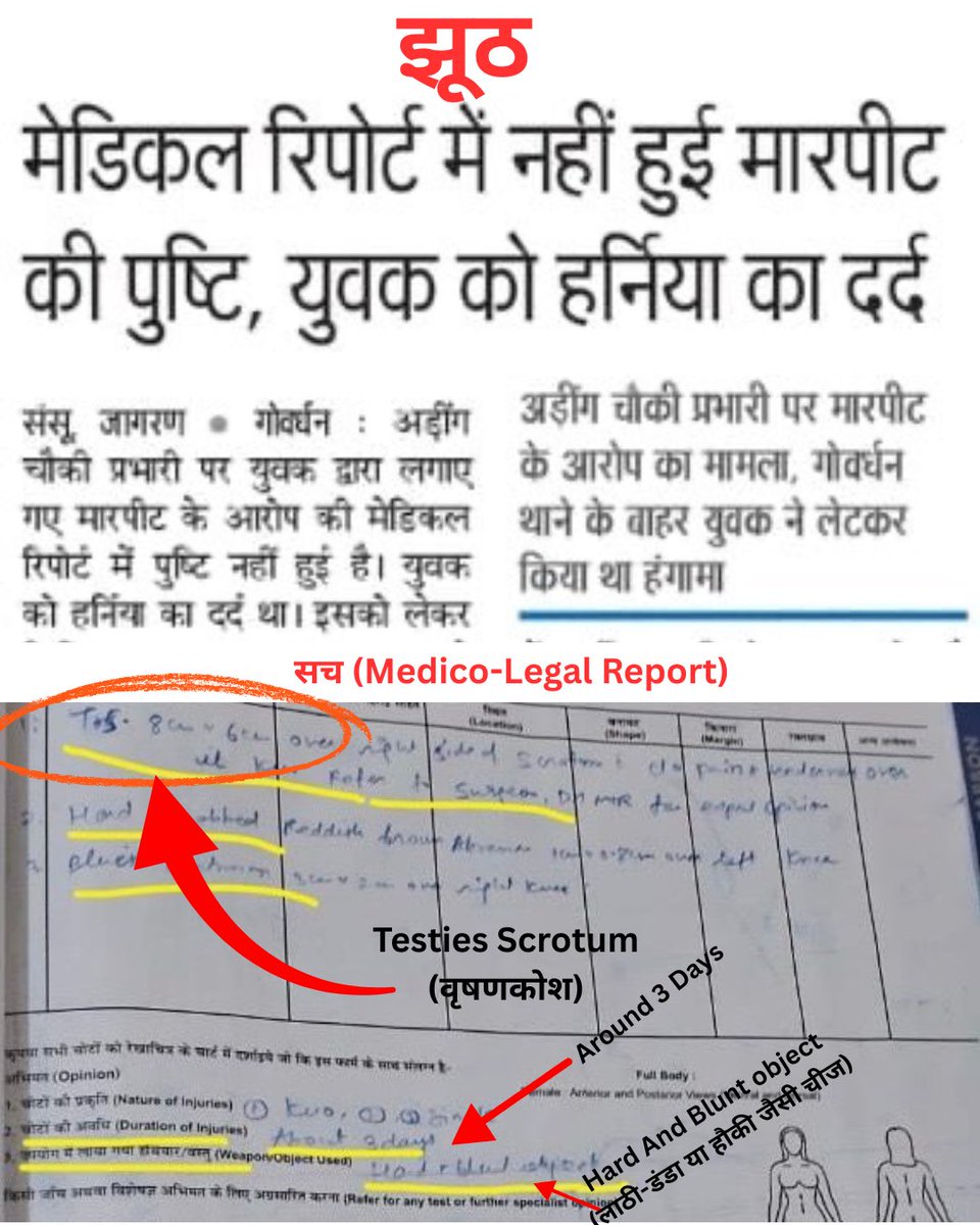 Shyam Meera Singh (@shyammeerasingh) on Twitter photo योगी-राज में निरंकुश पुलिस का असली सच
—-
उत्तर प्रदेश के डिप्टी CM <a href="/brajeshpathakup/">Brajesh Pathak</a> द्वारा मथुरा का मामला संज्ञान लेने के बाद और उप मुख्यमंत्री द्वारा मथुरा SSP एंड CMO को कॉल करने के बाद भी <a href="/mathurapolice/">MATHURA POLICE</a> अपराधी दरोगा बचाने में पूरी दम लगा रही है। इस खबर को मुझे स्वयं SSP ने योगी-राज में निरंकुश पुलिस का असली सच
—-
उत्तर प्रदेश के डिप्टी CM <a href="/brajeshpathakup/">Brajesh Pathak</a> द्वारा मथुरा का मामला संज्ञान लेने के बाद और उप मुख्यमंत्री द्वारा मथुरा SSP एंड CMO को कॉल करने के बाद भी <a href="/mathurapolice/">MATHURA POLICE</a> अपराधी दरोगा बचाने में पूरी दम लगा रही है। इस खबर को मुझे स्वयं SSP ने