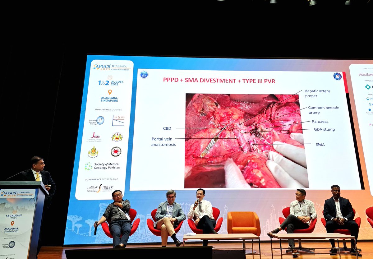 Shailesh V. Shrikhande (@shrikhande_sv) on Twitter photo Thank you <a href="/apgcs_summit/">APGCS2025</a> superb meeting with cutting edge interactions in pancreas cancer with my Asia pac colleagues <a href="/BrianKGoh/">Brian K. Goh</a> #pierce chow #alfred kow #han Chong Toh, Shaneenah And so many others! <a href="/EiocOncology/">Excellence in Oncology Care - EIOC</a> Thank you <a href="/apgcs_summit/">APGCS2025</a> superb meeting with cutting edge interactions in pancreas cancer with my Asia pac colleagues <a href="/BrianKGoh/">Brian K. Goh</a> #pierce chow #alfred kow #han Chong Toh, Shaneenah And so many others! <a href="/EiocOncology/">Excellence in Oncology Care - EIOC</a>