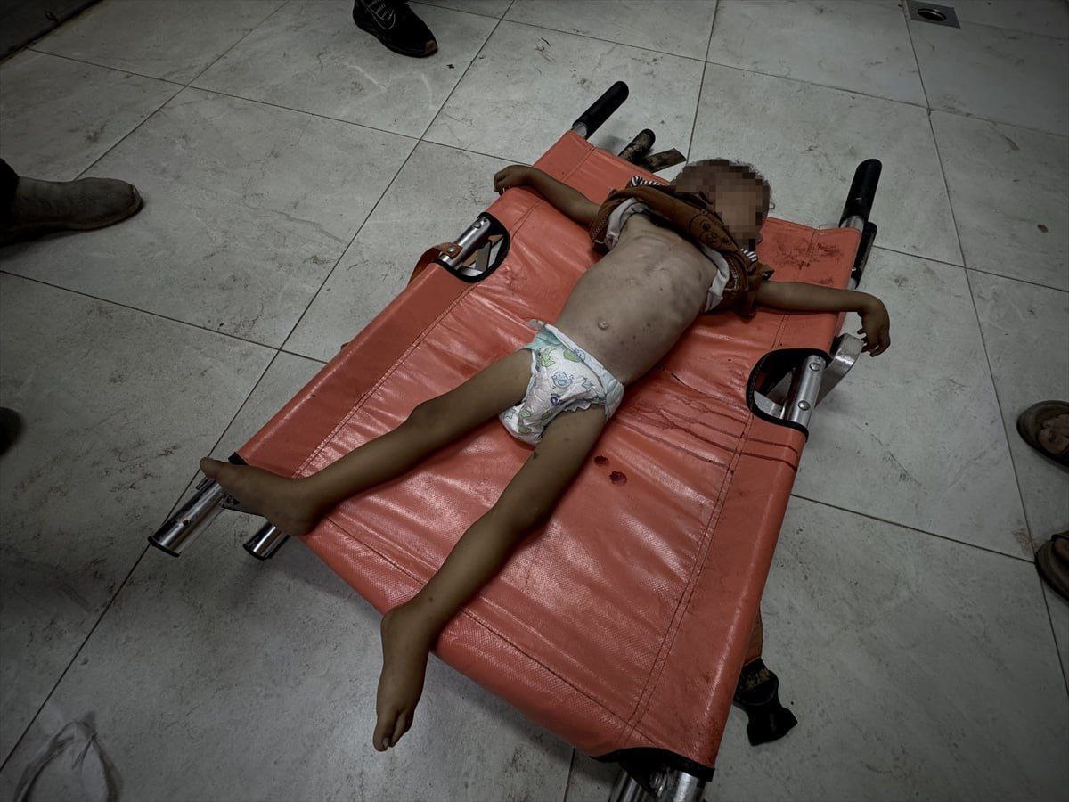 Another child starved to death in Gaza due to the Zionist Boars blockade

Remember the children of Gaza as you eat breakfast this morning

#WeAreHereForPalestine
#SahabatPalestina_ID
#StarvingGaza
#GazaGenocide
#FreePalestine
#ForeverPalestine