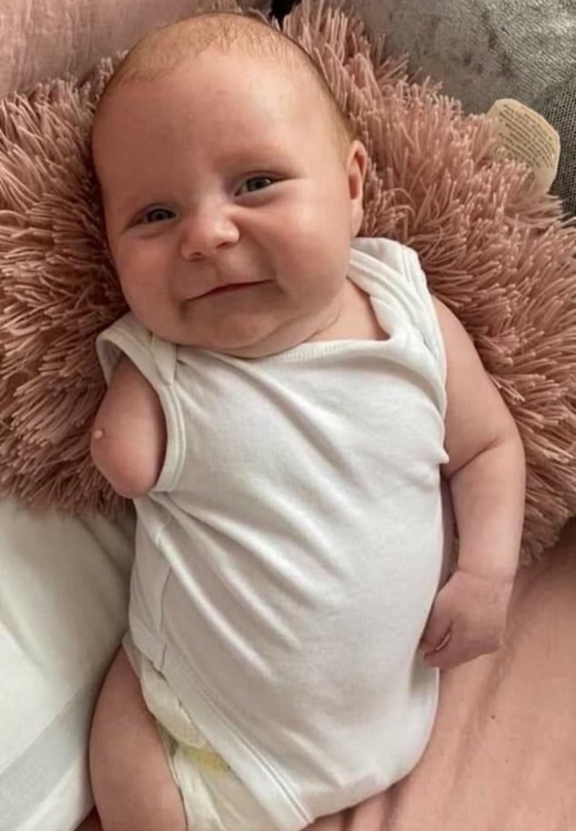 Meet Henry.

Born without legs, only one arm, and with a webbed hand.

Most people would’ve aborted him.

Calling him “inconvenient.”

He’s not a clump of cells.

He’s a human being worthy of life.