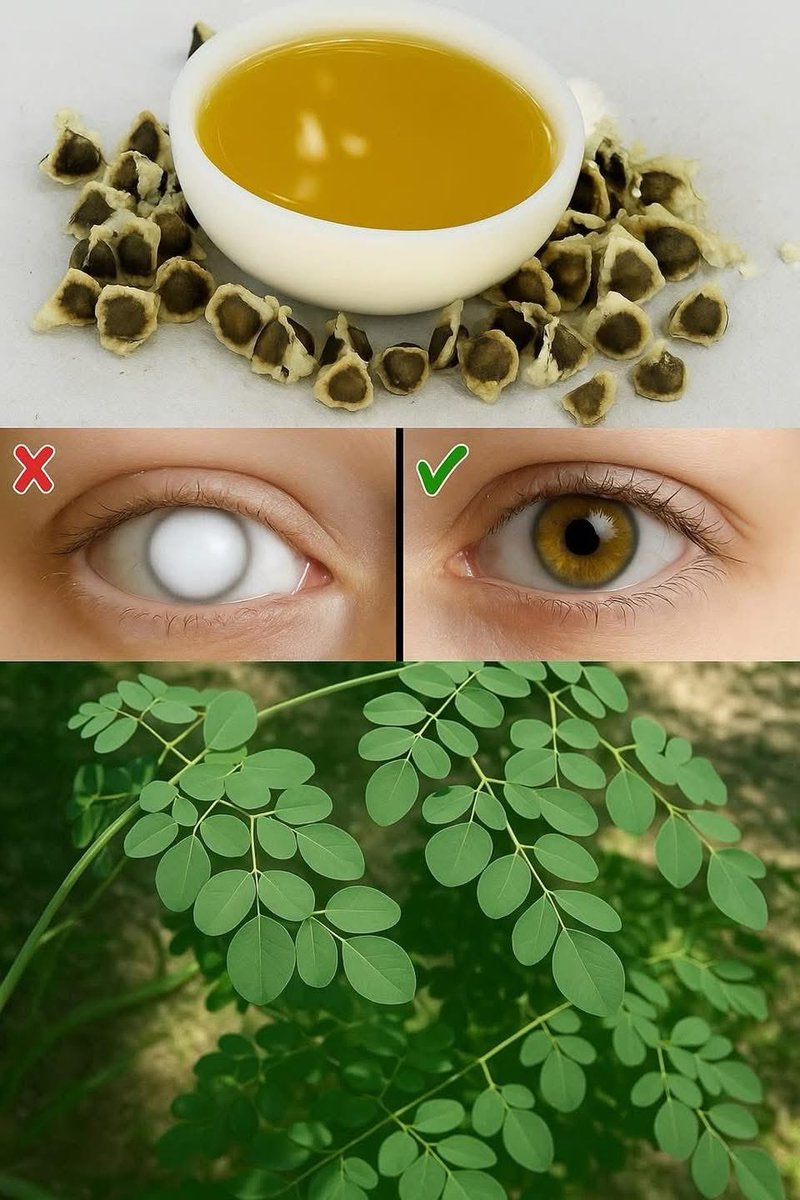 shyam_ayurveda's tweet image. Moringa seeds are known for their potential benefits in improving eye health, including cataract management.

Dosage: typically 2-3 seeds per day are recommended till improvement