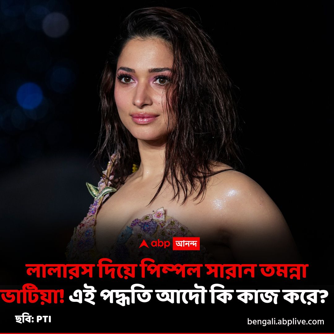 abpanandatv's tweet image. তমন্নার অবাক দাবি নিয়ে কী বলছেন বিশেষজ্ঞরা?
#TamannaahBhatia
#pimples

বিস্তারিত
bengali.abplive.com/photo-gallery/…