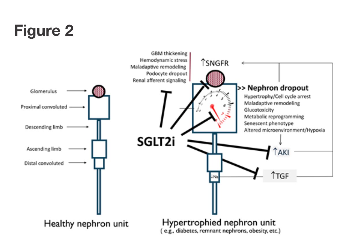 Giuseppe Maltese (@docmaltese) on Twitter photo In T1D, kidney decline remains a major threat despite advances in care.
New therapies like GLP-1RAs, SGLT2i & MRAs show promise, but their role in T1D needs trials.
Early kidney protection must be as vital as glucose control.
Via <a href="/DiabetesCareADA/">Diabetes Care, a research journal of the ADA 🌟</a>
<a href="/PrashVas/">Prash Vas</a> <a href="/kamleshkhunti/">Prof Kamlesh Khunti</a> In T1D, kidney decline remains a major threat despite advances in care.
New therapies like GLP-1RAs, SGLT2i & MRAs show promise, but their role in T1D needs trials.
Early kidney protection must be as vital as glucose control.
Via <a href="/DiabetesCareADA/">Diabetes Care, a research journal of the ADA 🌟</a>
<a href="/PrashVas/">Prash Vas</a> <a href="/kamleshkhunti/">Prof Kamlesh Khunti</a>