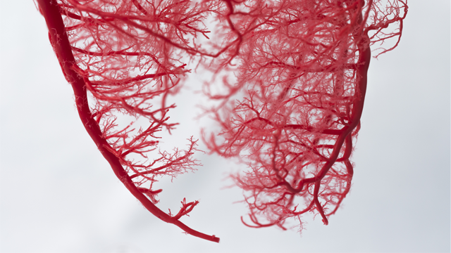 radcliffeCARDIO's tweet image. 📚 Latest News : "Exercise Stress Testing: A Useful Rule-Out Tool in Suspected ANOCA/INOCA"

 🔓Access it here 👉 ow.ly/bzAR106ivLh