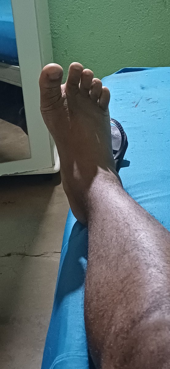 MarcosA13018881's tweet photo. Belo dia ... 🥰💙
beautiful day... 💙🥰
#packdepé #packdope #packdopezinho #pack #packdopézinho #pé #pe #foot #packfoot #vendadepack #packsale #sale #standingpack https://t.co/wSWooiIkLw