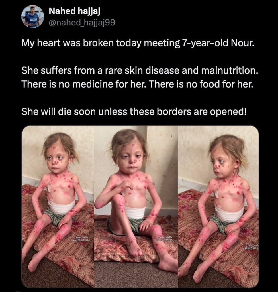 Humanity check 💔🇵🇸
If you’re scrolling, PLEASE leave a dot.
chuffed.org/project/136297