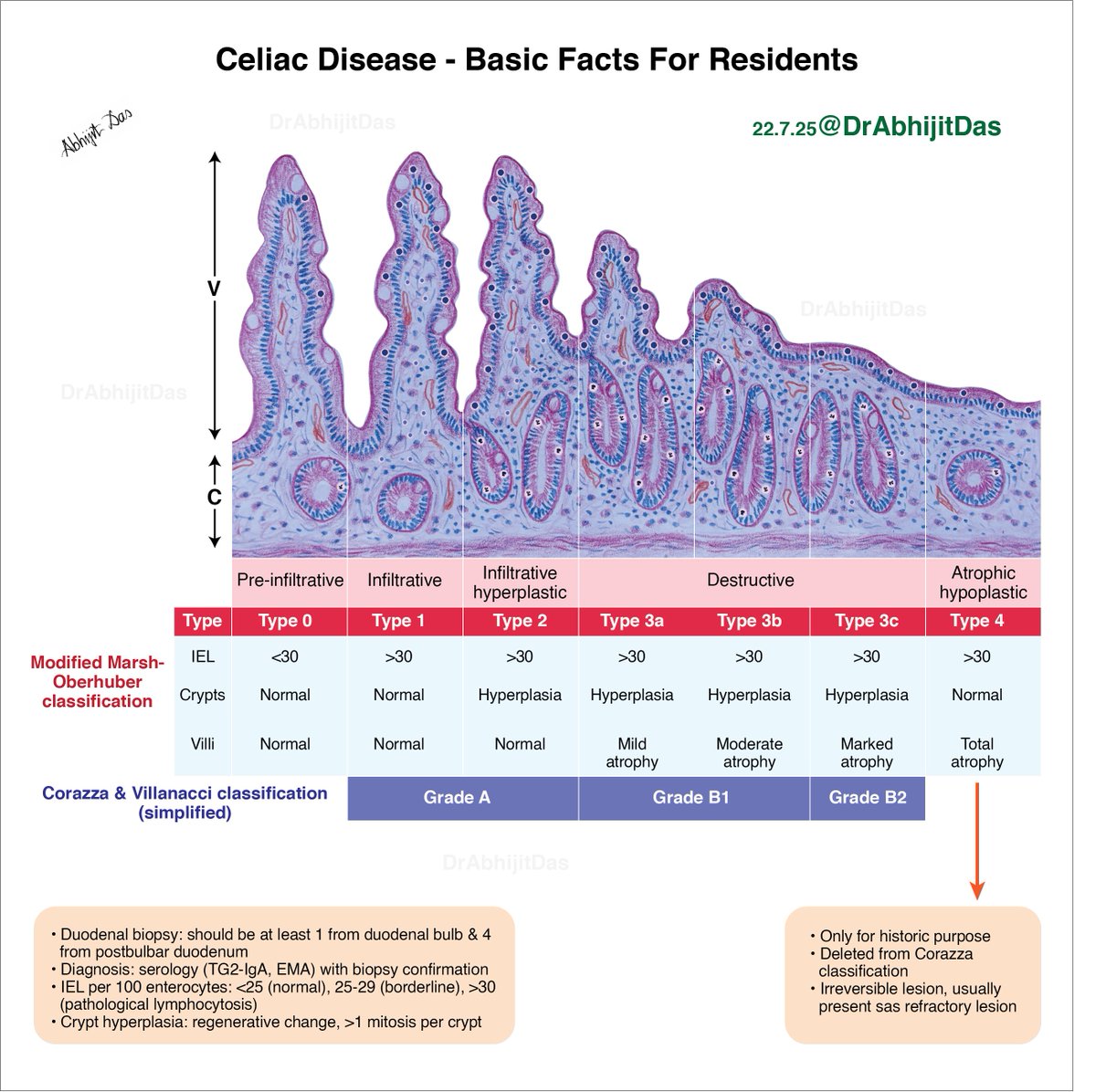 Celiac disease: Basic facts for residents
#CeliacDisease#
#HistoScoresGrades#
#BasicFactsForResidents#
#MakeSurgiPathEasy#