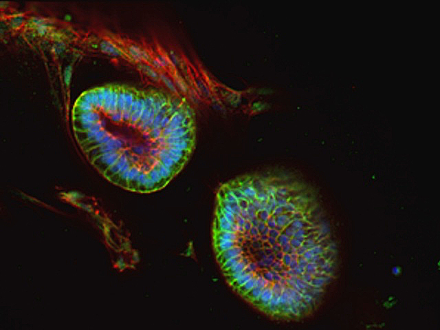 Human foetal kidney-derived organoids grown for prolonged periods as faithful models of kidney development show Notch is developmental regulator

📷 Michael Namestnikov et al Sheba Medical Center, Tel HaShomer, Israel in <a href="/embojournal/">The EMBO Journal</a> 
➡️ bpod.org.uk/archive/2025/8…