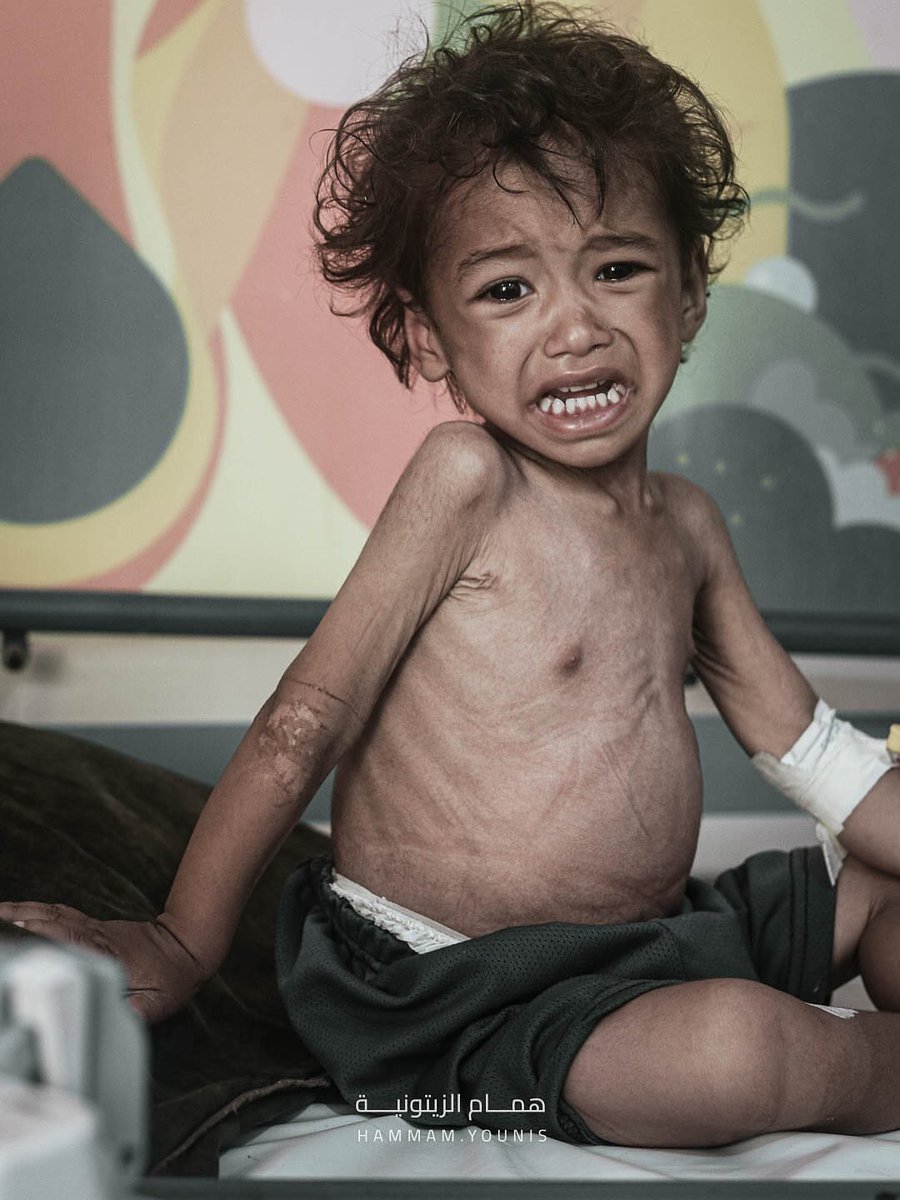 Pray for this little angel.💔
If you see this pic, reply with 🍉🇵🇸And spread it💔