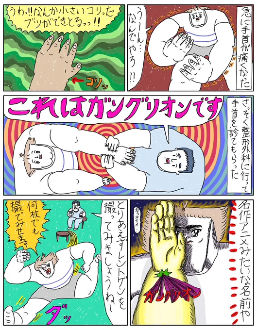 ガングリオンができちまった…

続きあります↓ 