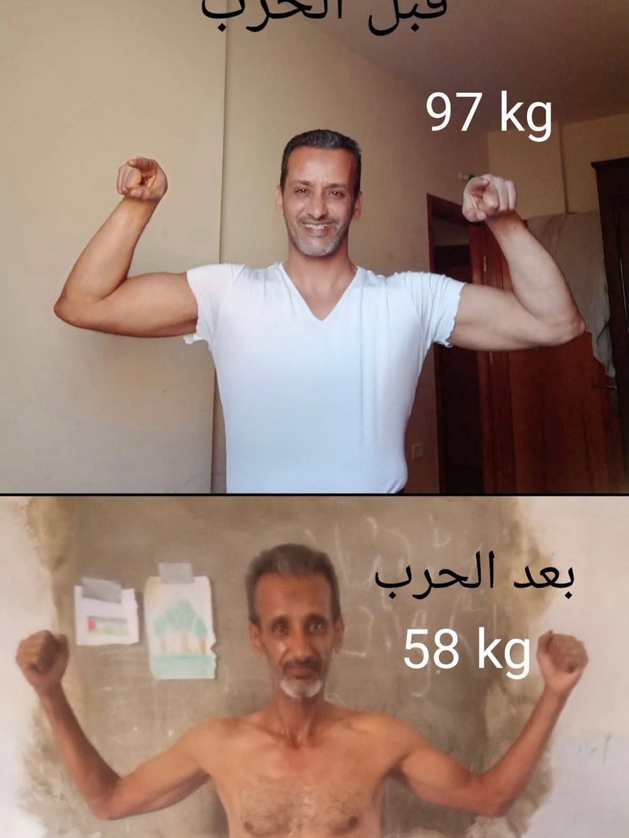 Bir Gazzelinin, açlık nedeniyle yaşadığı içler acısı değişim.