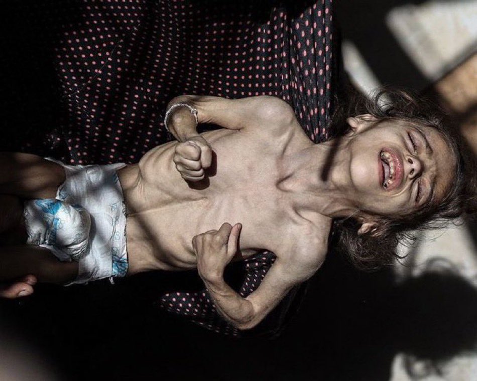 Allah'ım ebabil kuşlarının vakti gelmedi mi artık....😔
#HearGazasCry