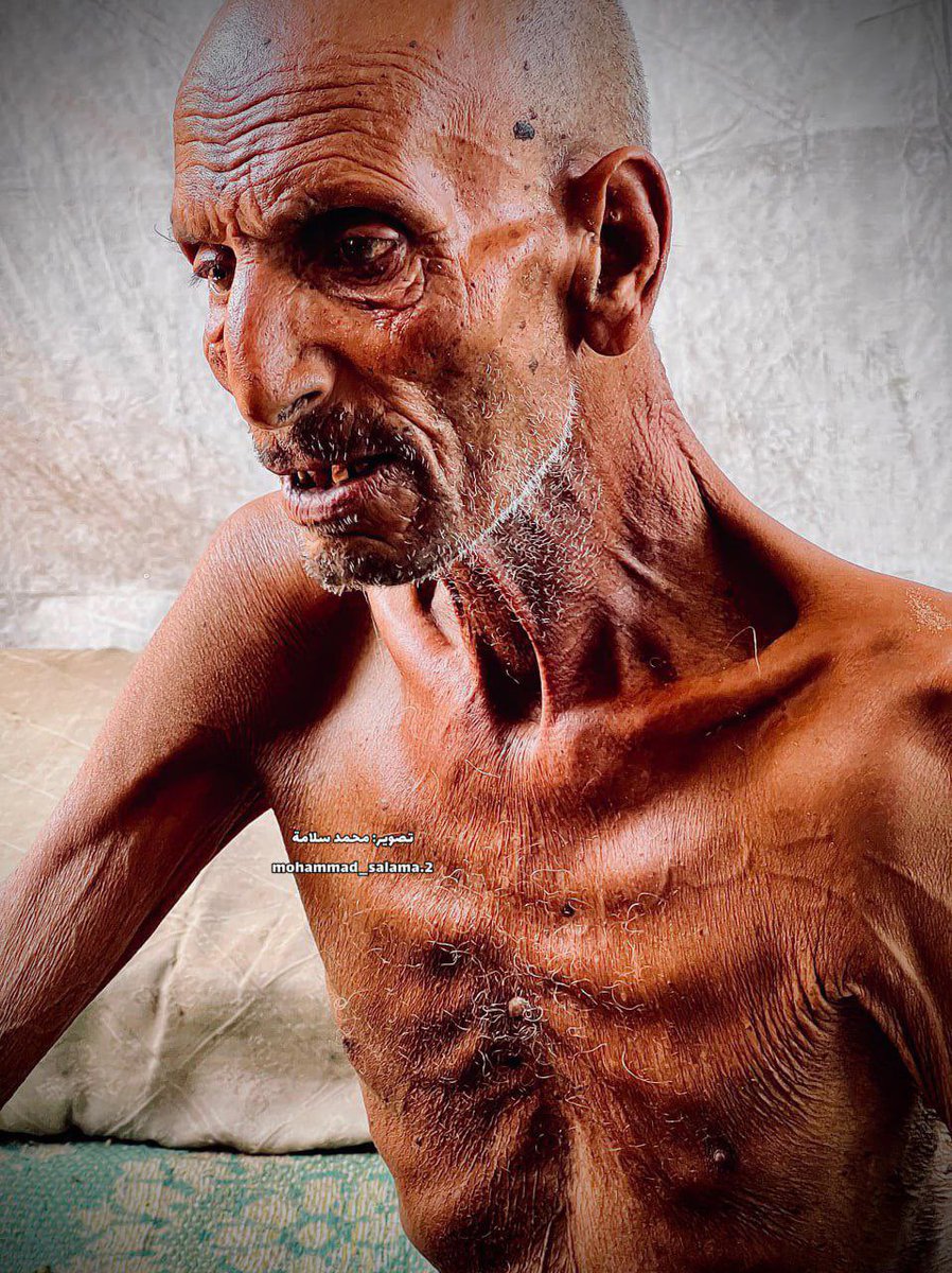hamoodalnoofli's tweet photo. #عاجـــــــــــــــــــــــل
⛔نداء لكل الأحرار:
⛔كل ما عليك هو نسخ هذه الحسابات والوسوم ثم تغرد بصور ومقاطع عن معاناة غزة، لأن المبعوث الأمريكي نقل للعالم أنه لا توجد مجاعة فلا بد من فضحه. 

🌍 شاركوا في تغريداتكم حسابات الأمم المتحدة والمنظمات الدولية المؤثرة 
 @UNRWAarabic  
   @UNICEF 
@UN
@MSF_intl   
 @IfNotNowOrg    
 @CodePink  
 @Artists4Ceasefire
  @UNRW                
            @UNICEF                        @MSF_intl               @IfNotNowOrg          
 @CodePink                        @Artists4Ceasefire
 
⛔قائمة الوسوم الاجنبية المتصدرة حاليا:
#Gaza
#GazaUnderAttack
#FreePalestine
#Palestine
#SaveGaza
#GazaCrisis
#BoycottIsrael
#BDSMovement
#IsraeliApartheid
#AllEyesOnRafah

⛔قائمة الوسوم العربية:
#غزه_تموت_جوعاً 
#غزه_تباد_وتحرق 
#غزة_تُجوع
#غزة