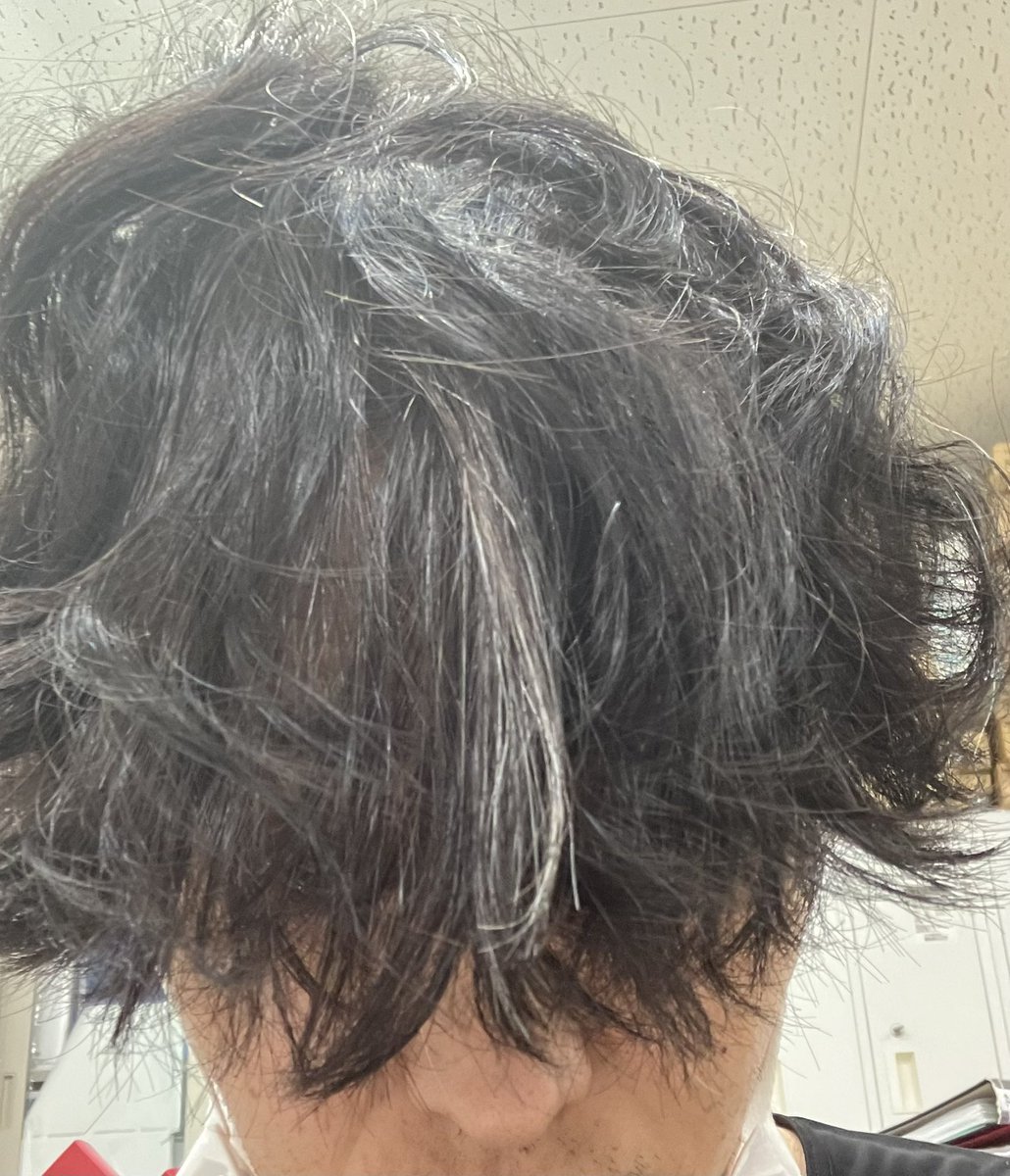 38歳のリアルな白髪