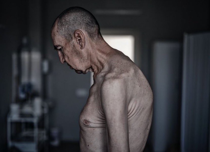 Ukrainian soldiers after Russian captivity