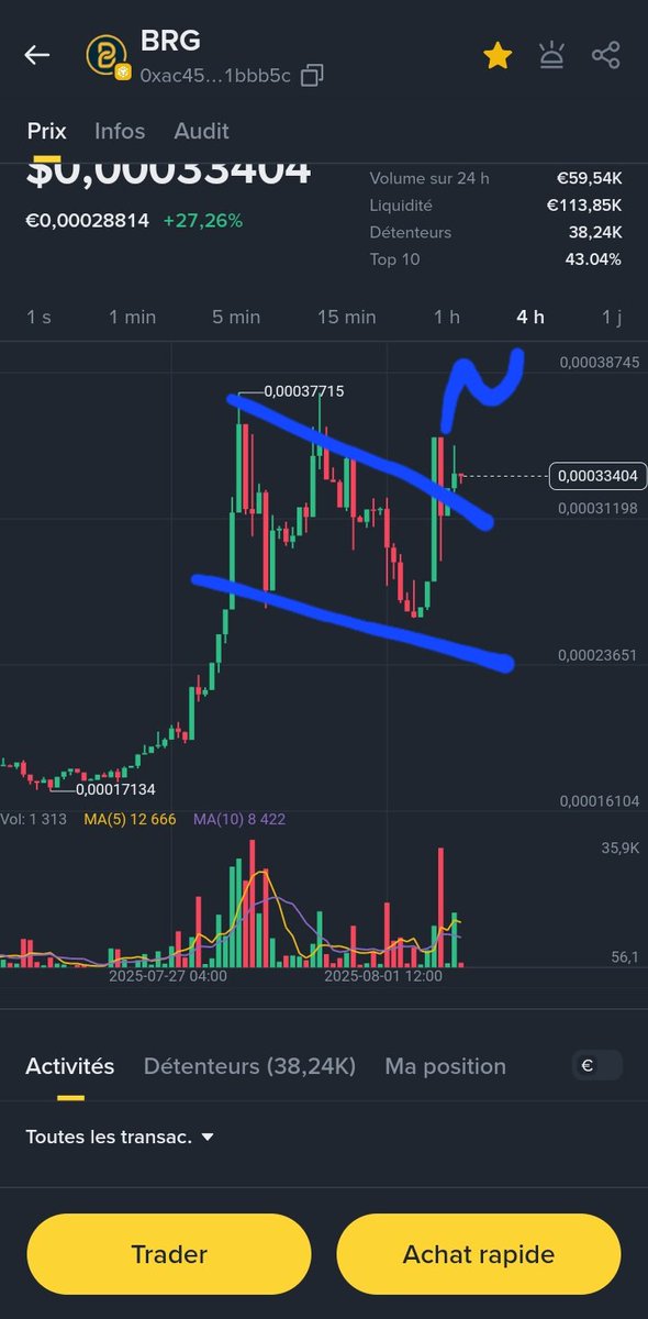 Zouzoua_1er's tweet photo. @cb_doge Look at my face $BRG 📊 https://t.co/cViJyd2emI