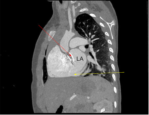 Congenital Cardiology Today tweet media