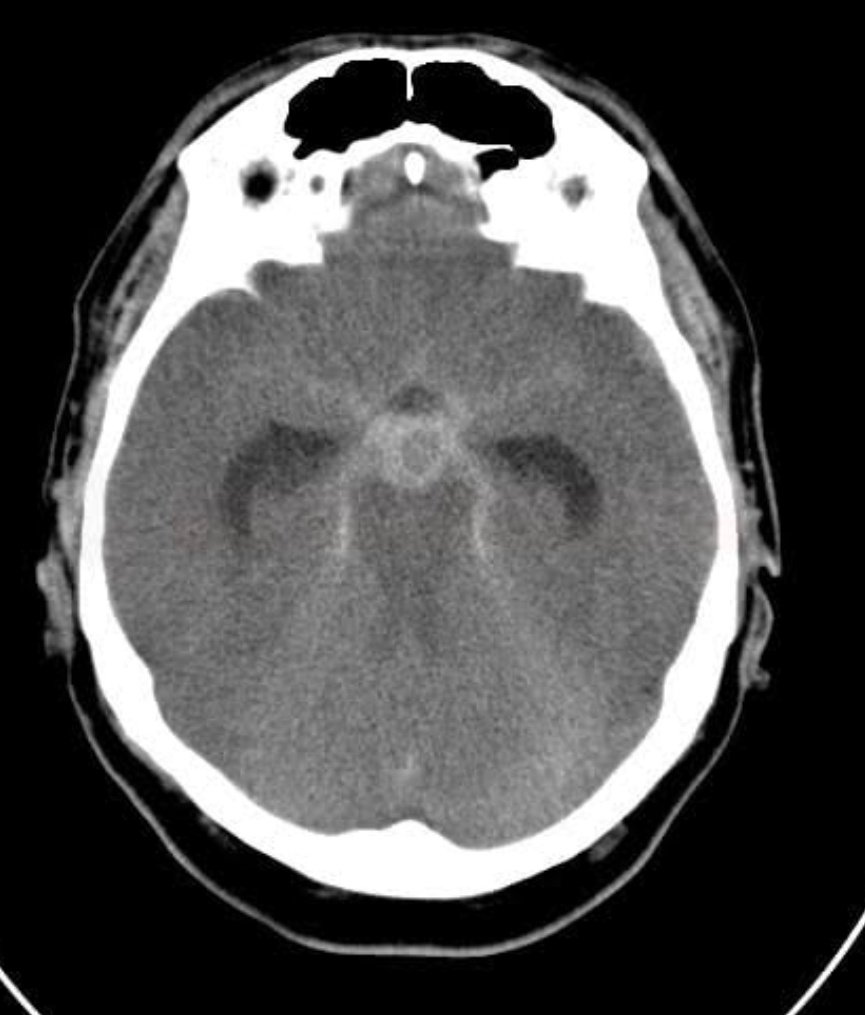 Neuromed tweet media