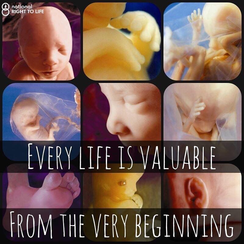 Every life is valuable from the beginning.