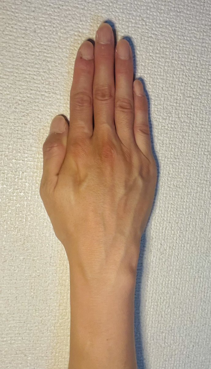 ３日目…毎日ツイートするのって大変なんやな…。
数億年ぶりに爪を固めました！