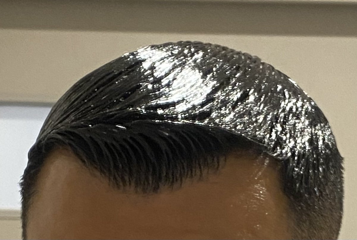 筋を完全に無くすのはなかなか難しい