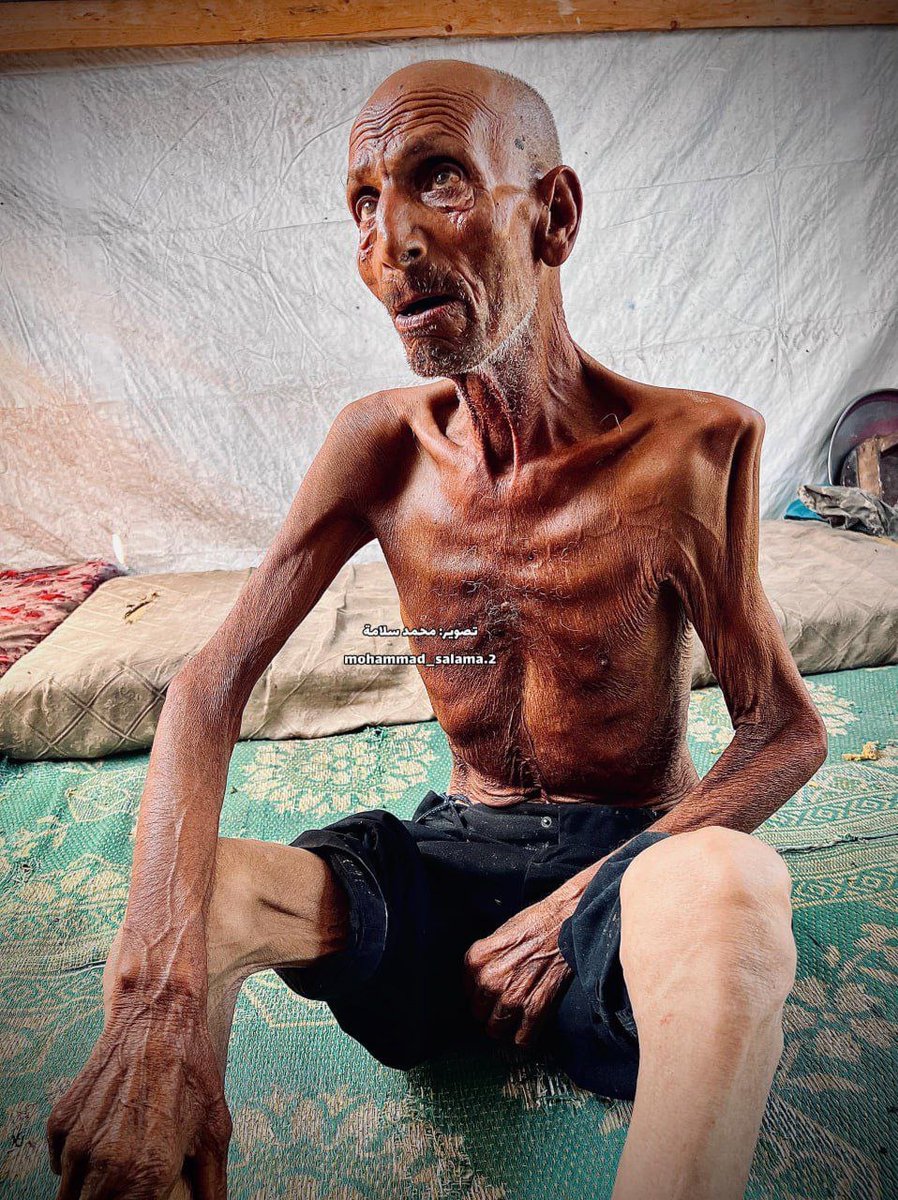 المجاعة مستمرة..

 مؤذن مسجد الصحابة في عبسان الجديدة شرق خانيونس سليم عصفور يعاني من المجاعة وسوء التغذية في قطاع غزة