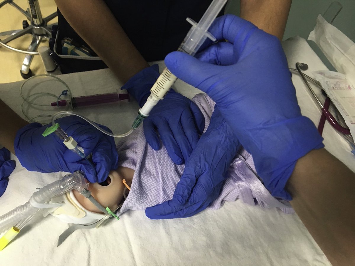 Study finds that non-pharmacological care prior to LISA for surfactant administration may be enough without giving fentanyl.  No difference between saline or fentanyl on COMFORTNeo score

pubmed.ncbi.nlm.nih.gov/40753114/
<a href="/neo_twiter/">🤖#𝕟𝕖𝕠𝕋𝕨𝕚𝕥𝕥𝕖𝕣</a>