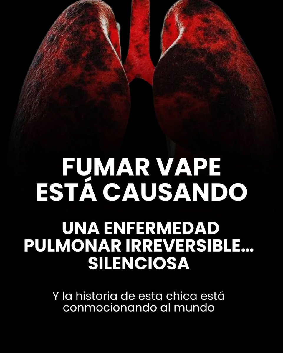Una mujer joven de Ohio, Estados Unidos. Le acaban de sacar 2 litros de un líquido negro extraño y con sangre directamente de los pulmones.

Si, dos litros, Ella estaba sana y comenzó a vapear “solo por ansiedad”.

Semanas después, colapsó en casa. Su novio la encontró